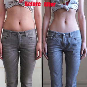 TechSculpt Slimming Patches